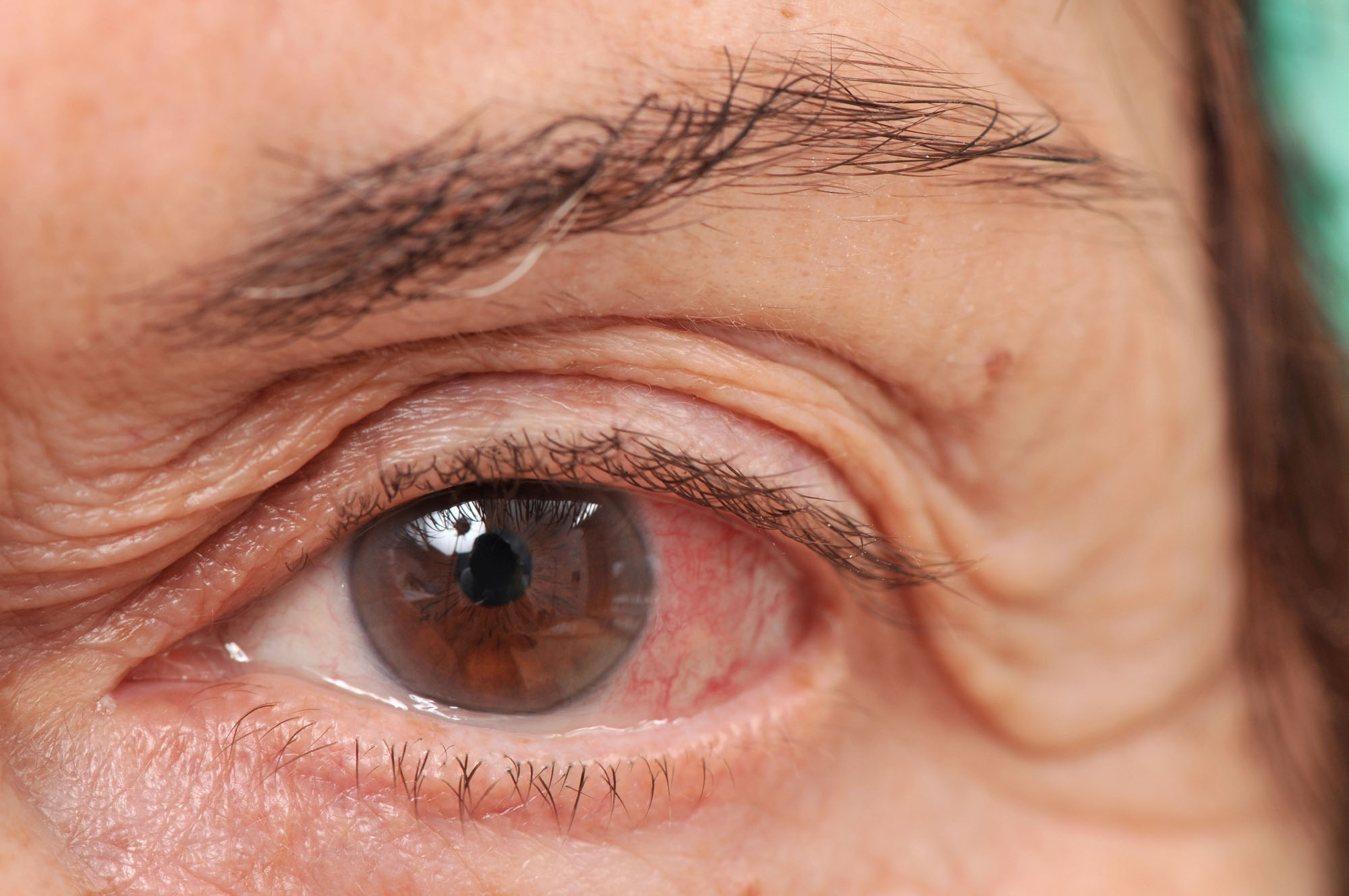 bigstock High resolution macro photo of 19472408