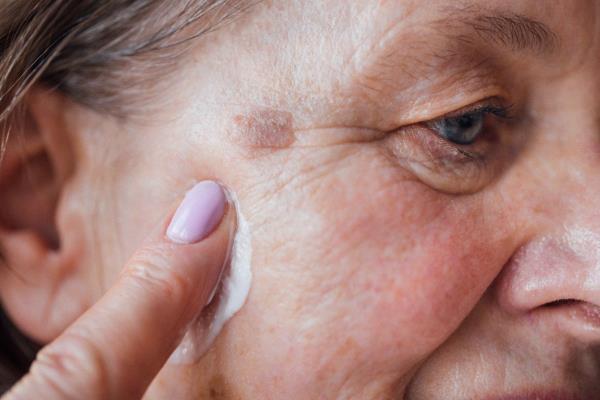 Skin Cancer Awareness Protecting the Skin You’re In. Home Instead of Sunnyvale, CA
